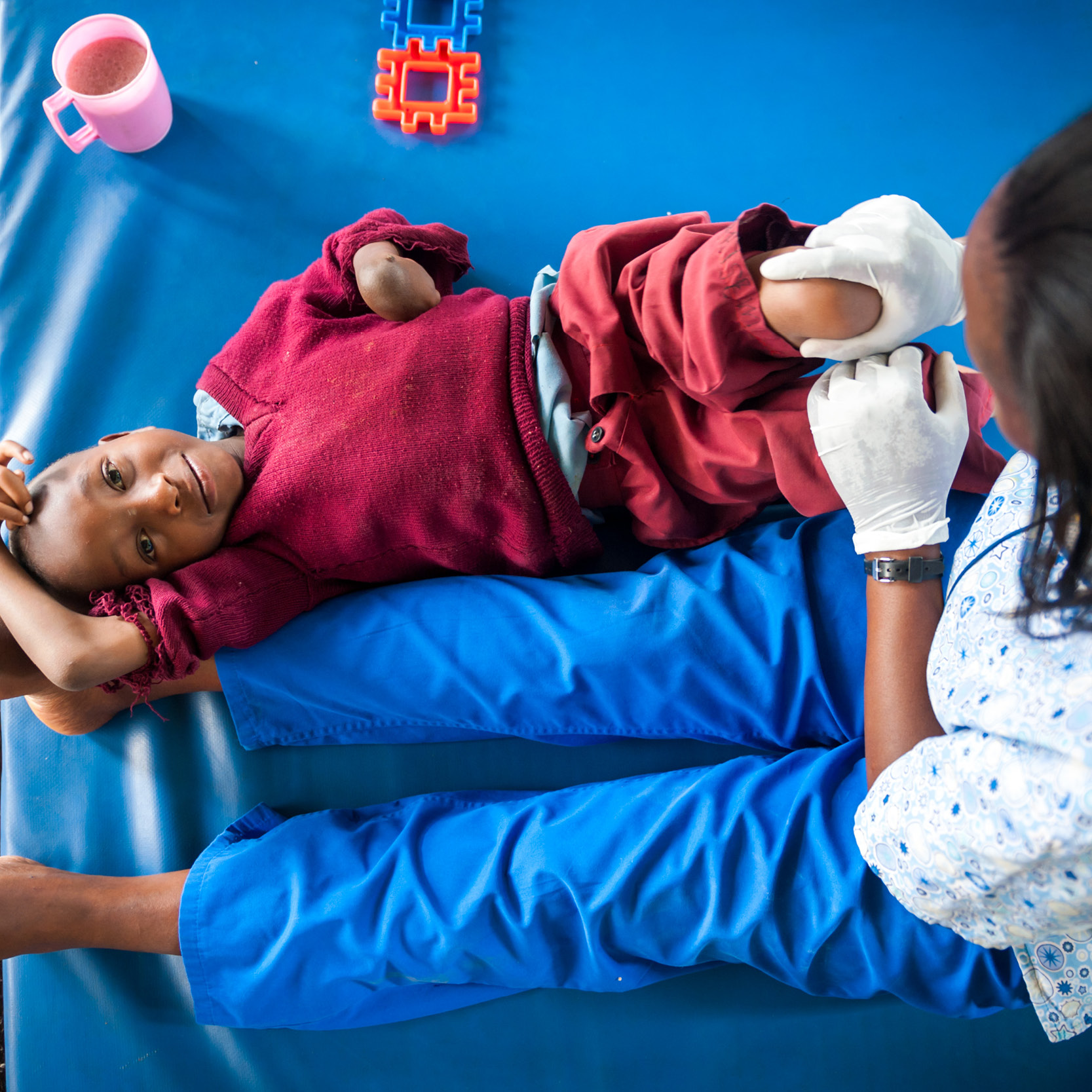 Photo of smiling boy from Kenya receiving physiotherapy